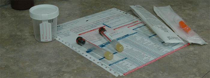 urine drug test sample